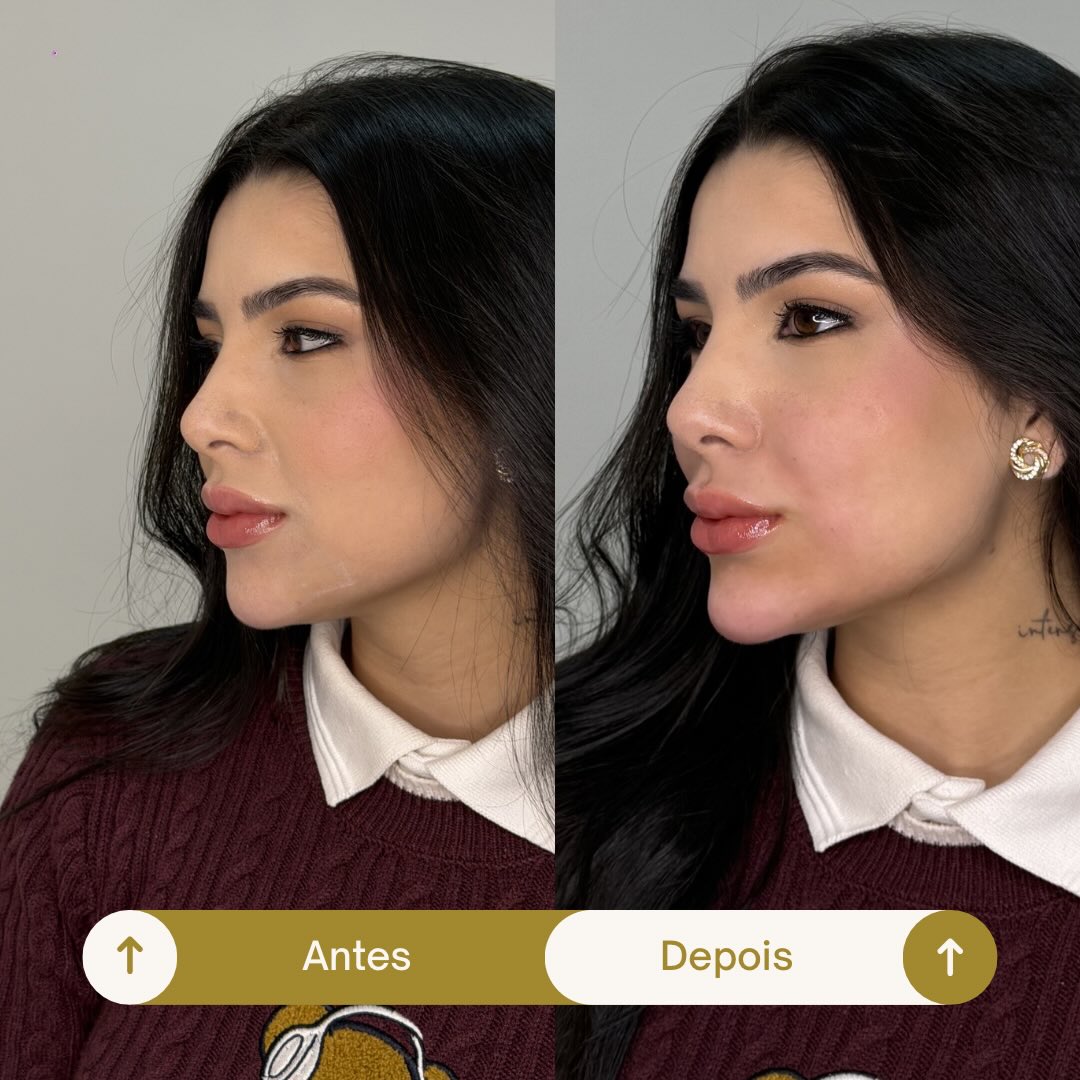 Imagem de lábios publicada no Instagram da profissional